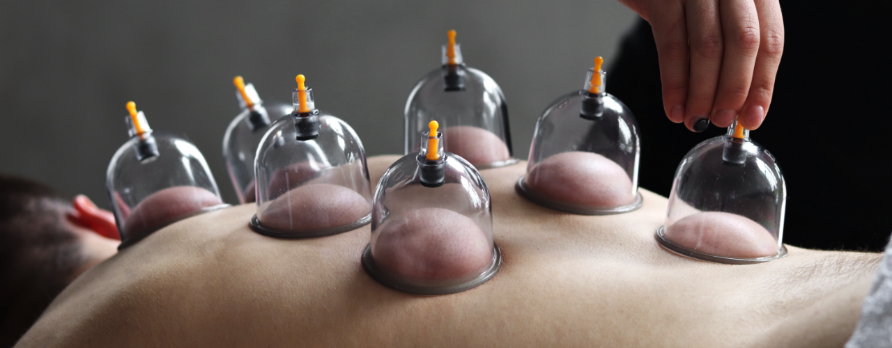 Cupping Arizona