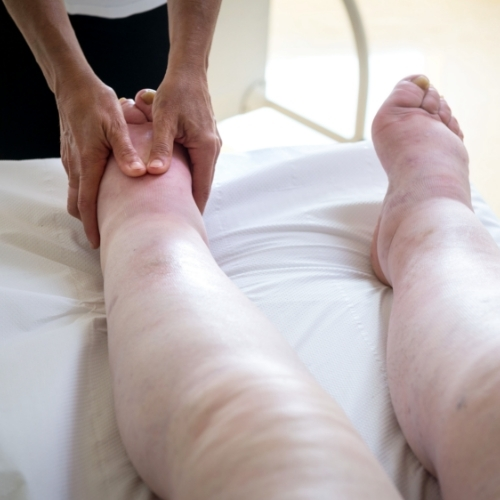 lymphedema-GTS-Physical-Therapy-Arkansas