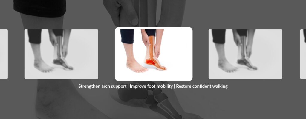 Foot Pain No More: Managing Arch Pain through Physical Therapy